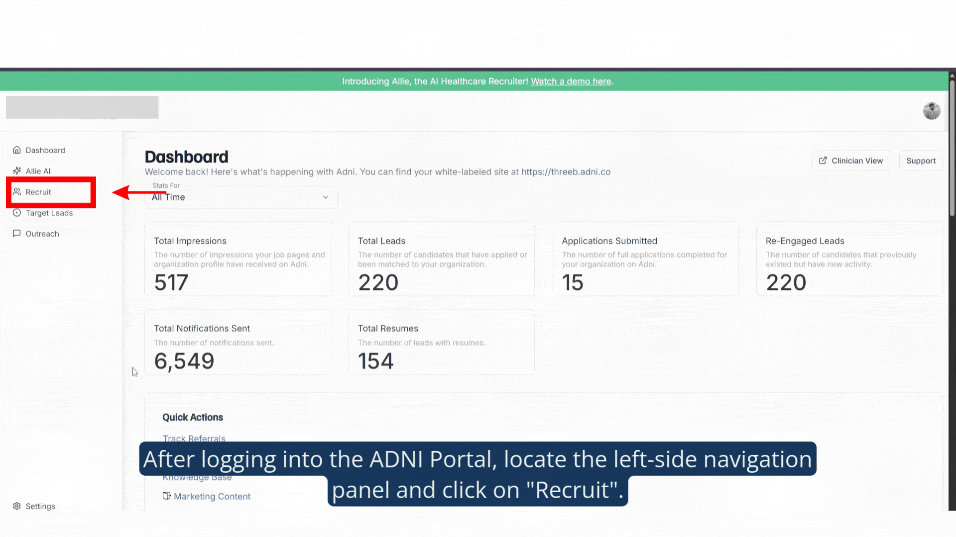 ADNI Portal (1).gif