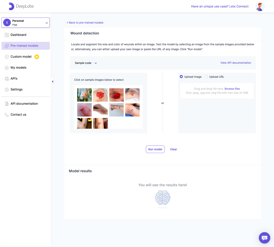 Deeplobe - Wound detection functionality