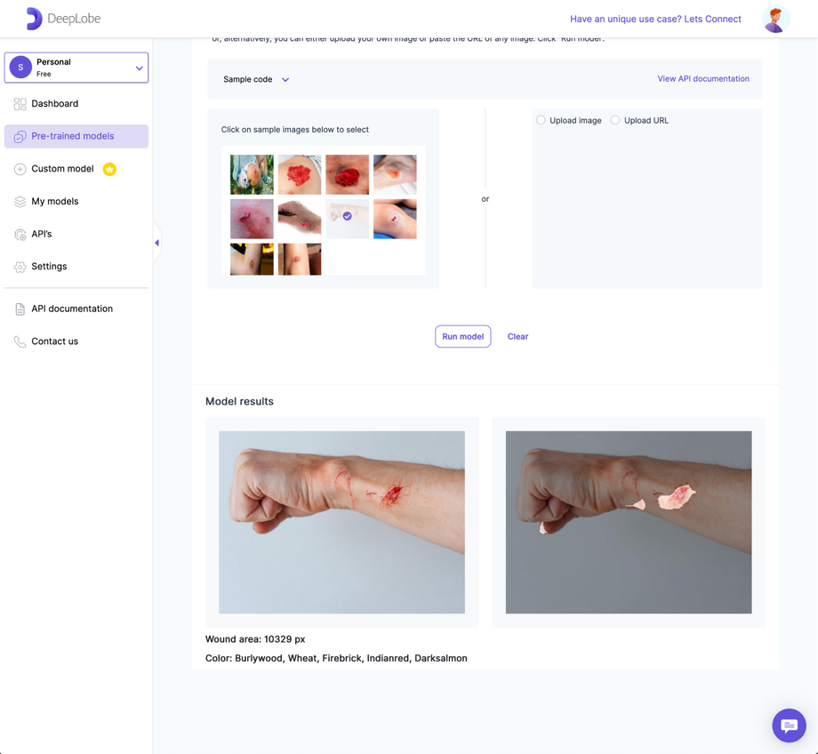 Deeplobe - Wound detection result page